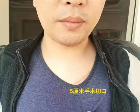 38歲男教師嗓音嘶啞1373